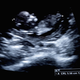 Image for article titled A Fetus Is Not a Person, But a Pregnant Woman Sure as Hell Is
